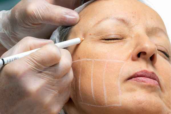 CryoPen: 5 Skin Concerns It May Be Used to Treat 4 What should you ask before having CryoPen treatment Basildon?