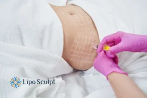 Are The Results From Aqualyx Permanent? 1 Do you want to know how long Aqualyx Basildon results last?