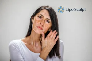 Cryopen: The Revolutionary Treatment for Age Spots Unveiled 5 Get your confidence back today! Removal your age spots Basildon - book in today!