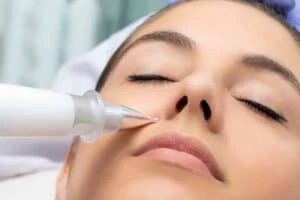 Best Actinic Keratoses Removal 3 Actinic keratoses Basildon solutions - book in today!