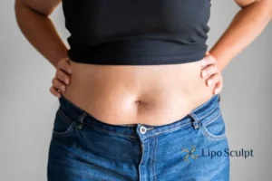 Bidding Farewell to Muffin Tops with Aqualyx Fat Injections 2 Do you wish you could reduce your muffin top Basildon With Aqualy fat dissolving injections you can!