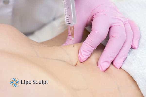 Aqualyx for Muffin Tops: What to Know Before Fat-Dissolving Injections 4 Are there risks Basildon?