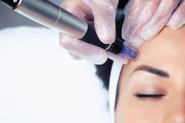 Explaining Total Skin Tightening Treatment and What to Expect 2 What Skin Concerns Can Total Skin Tightening Treatment Help With Basildon?